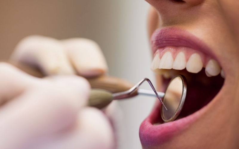 CEO de Ibiporã realiza mais de 2.500 atendimentos odontológicos nos primeiros meses de 2025